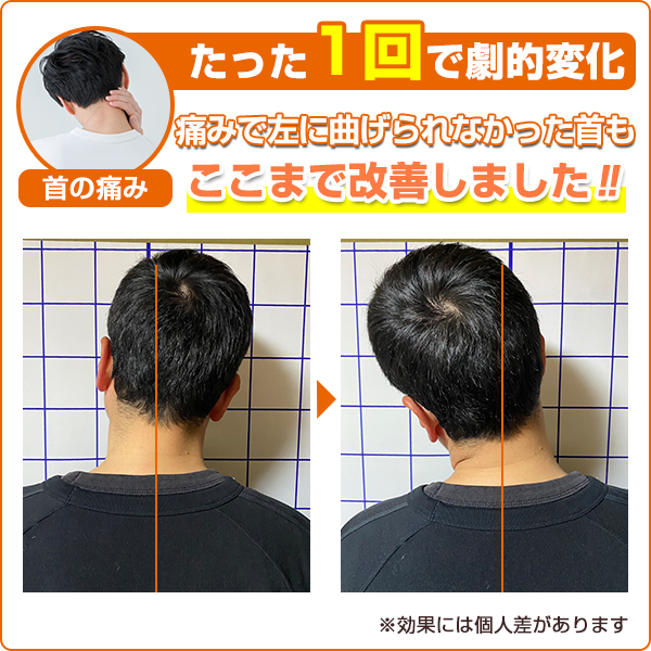 ビフォーアフター：首の痛み