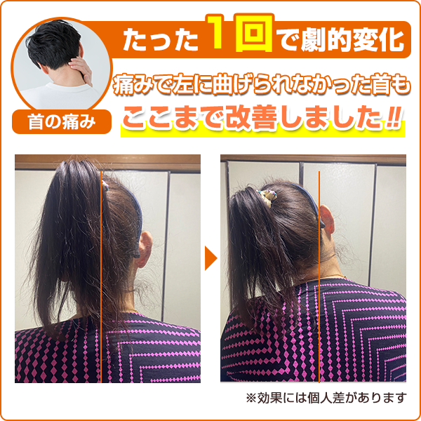 ビフォーアフター：首の痛み