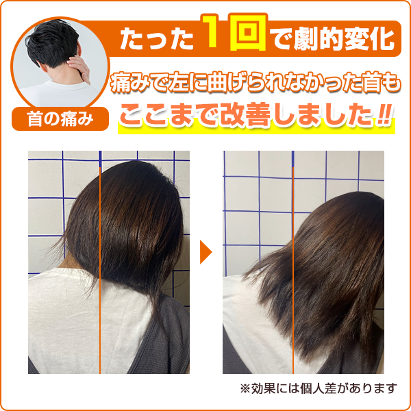 ビフォーアフター：首の痛み