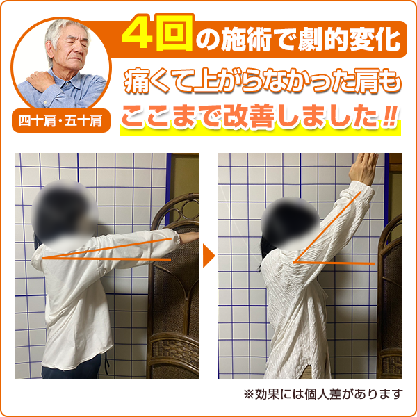 ビフォーアフター