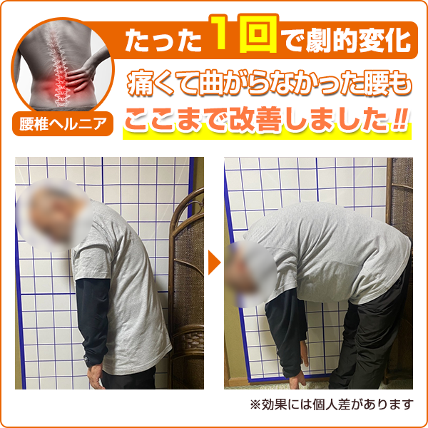 ビフォーアフター