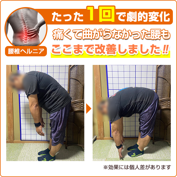 ビフォーアフター：四十肩・五十肩