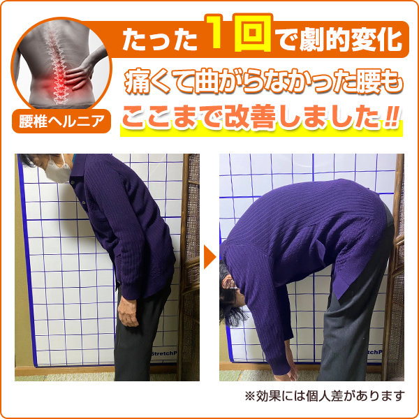 ビフォーアフター：四十肩・五十肩